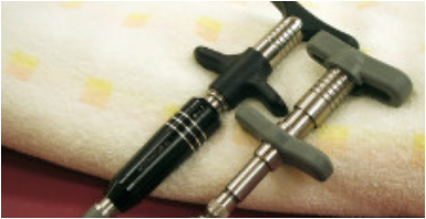 アクティベータメソット