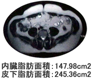 内臓脂肪を減少させる 通電前