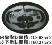 内臓脂肪を減少させる 通電後